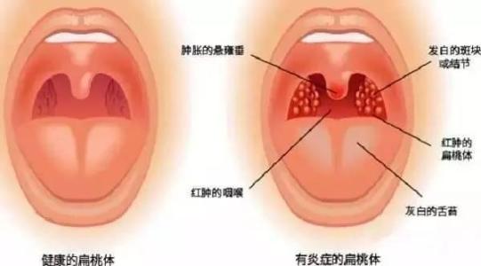 读懂免疫系统的组成 营养健康- 中国螺旋藻产业从这里